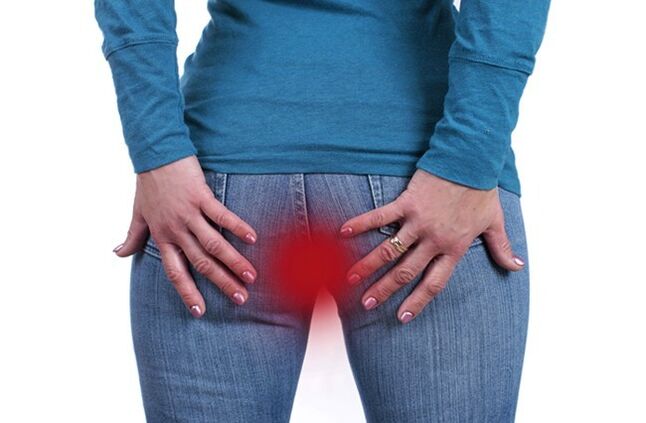 Itching in anal region is a sign of the presence of worms